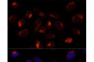 Immunofluorescence analysis of U-2 OS cells using TXNDC12 Polyclonal Antibody at dilution of 1:100 (40x lens). (TXNDC12 Antikörper)