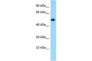 WB Suggested Anti-Zbtb44 Antibody Titration: 1.