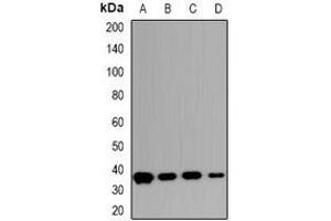 Western blot analysis of Carbonic Anhydrase 13 expression in HepG2 (A), HCT116 (B), mouse intestines (C), rat intestines (D) whole cell lysates. (CA13 Antikörper)
