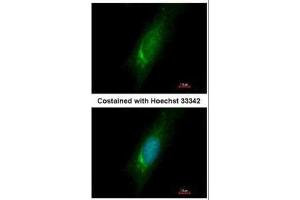 ICC/IF Image Immunofluorescence analysis of methanol-fixed HeLa, using Homer3, antibody at 1:500 dilution. (HOMER3 Antikörper  (Center))