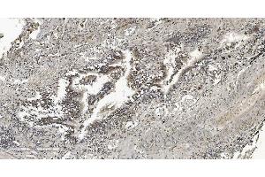 IHC analysis of HP1 alpha/CBX5 using anti-HP1 alpha/CBX5 antibody (ABIN7599057). (CBX5 Antikörper  (AA 1-191))