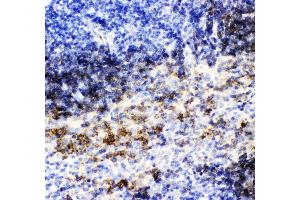 Anti- CD79B picoband antibody,IHC(P) IHC(P): Mouse Spleen Tissue (CD79b Antikörper  (AA 29-229))