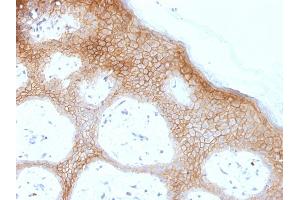 Formalin-fixed, paraffin-embedded human skin stained with Desmoglein-1 Monoclonal Antibody (DSG1/1733). (Desmoglein 1 Antikörper)