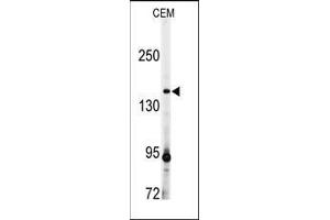 Western Blotting (WB) image for anti-ADAM Metallopeptidase with Thrombospondin Type 1 Motif, 13 (ADAMTS13) (AA 836-866) antibody (ABIN359601)