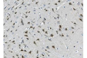 IHC analysis of Calretinin/CALB2 using anti-Calretinin/CALB2 antibody (ABIN7602106).