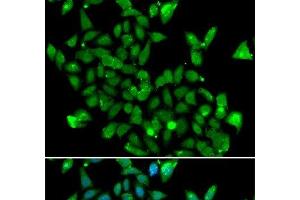Immunofluorescence analysis of MCF-7 cells using ASPA Polyclonal Antibody (ASPA Antikörper)