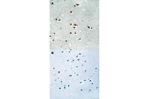 Immunohistochemical staining (Formalin-fixed paraffin-embedded sections) of human brain tissue with FER (phospho Y402) polyclonal antibody  without blocking peptide (A) or preincubated with blocking peptide (B) under 1:50-1:100 dilution. (FER Antikörper  (pTyr402))