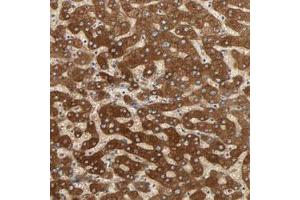 Immunohistochemical staining (Formalin-fixed paraffin-embedded sections) of human liver with PYGL polyclonal antibody  shows strong cytoplasmic positivity in hepatocytes. (PYGL Antikörper)