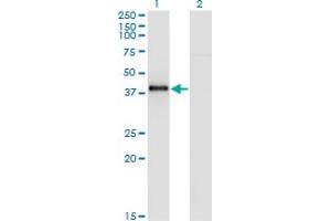 Western Blot analysis of NKX2-5 expression in transfected 293T cell line by NKX2-5 monoclonal antibody (M05), clone 4B11.