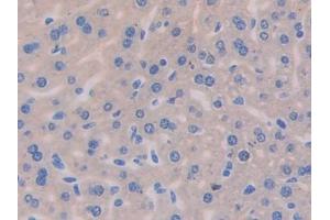 DAB staining on IHC-P; Samples: Mouse Liver Tissue (IL13 Receptor alpha 1 Antikörper  (AA 201-360))