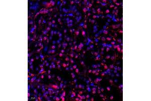 Immunofluorescence of paraffin embedded rat kidney using USP34 (ABIN7076115) at dilution of 1:700 (400x lens)