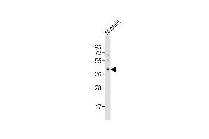 Anti-Rad9a Antibody (N-term) at 1:2000 dilution + M.