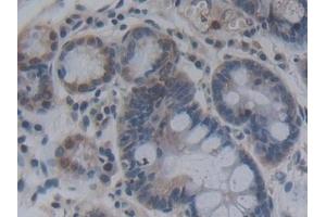 Immunohistochemistry (IHC) image for anti-Fibroblast Growth Factor 12 (FGF12) (AA 1-181) antibody (ABIN7435244)