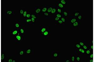 Immunofluorescent analysis of HepG2 cells using ABIN7161805 at dilution of 1:100 and Alexa Fluor 488-congugated AffiniPure Goat Anti-Rabbit IgG(H+L) (PPP1R8 Antikörper  (AA 1-209))