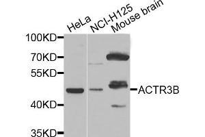 Western blot analysis of extracts of various cell lines, using ACTR3B antibody. (ACTR3B Antikörper)