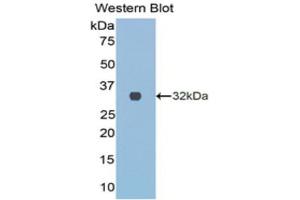 Western Blotting (WB) image for anti-Collagen, Type III, alpha 1 (COL3A1) (AA 1171-1435) antibody (ABIN1077676) (COL3A1 Antikörper  (AA 1171-1435))