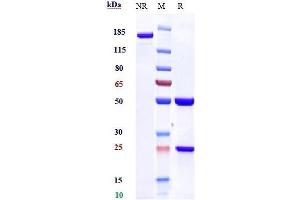 Anti-PDCD1 / PD-1 / CD279 Reference Antibody (nivolumab) on SDS-PAGE under reducing (R) condition. (Rekombinanter PDCD1 (Nivolumab Biosimilar) Antikörper)