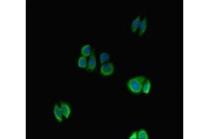 Immunofluorescent analysis of HepG2 cells using ABIN7161789 at dilution of 1: 100 and Alexa Fluor 488-congugated AffiniPure Goat Anti-Rabbit IgG(H+L) (NFATC1 Antikörper  (AA 48-406))