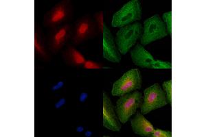ABIN6260073 and ABIN6278423 staining  cells by IF/ICC. (ASCL1 Antikörper  (C-Term))