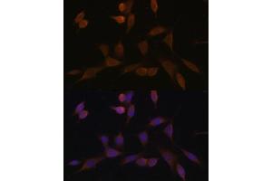 Immunofluorescence analysis of NIH-3T3 cells using NDUF Polyclonal Antibody (ABIN7268804) at dilution of 1:100 (40x lens). (NDUFA5 Antikörper  (AA 1-116))