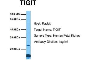 Host: Rabbit Target Name: TIGIT Sample Tissue: Human Fetal Kidney Antibody Dilution: 1. (TIGIT Antikörper  (C-Term))
