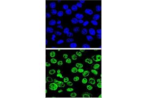 Confocal immunofluorescent analysis of MDM2 Antibody  (ABIN388067 and ABIN2845752) with Hela cell followed by Alexa Fluor® 488-conjugated goat anti-rabbit lgG (green). (MDM2 Antikörper  (AA 141-176))