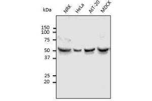 Anti-Tubulin alpha4A Ab at 1,000 dilution, lysates at 100 µg per Iane, Rabbit polyclonal to goat IgG (HRP) at 1/10,000 dilution. (TUBA4A Antikörper  (N-Term))