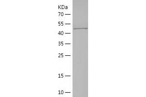 Western Blotting (WB) image for Myosin Heavy Chain 2, Skeletal Muscle, Adult (MYH2) (AA 22-304) protein (His-IF2DI Tag) (ABIN7283913) (MYH2 Protein (AA 22-304) (His-IF2DI Tag))