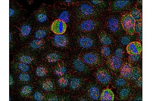 Immunofluorescence staining of Fyn in human HeLa cell line using anti-Fyn (FYN Antikörper  (AA 7-176))