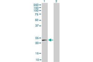 Western Blotting (WB) image for anti-Mitochondrial Ribosomal Protein L12 (MRPL12) (AA 1-199) antibody (ABIN598585) (MRPL12 Antikörper  (AA 1-199))