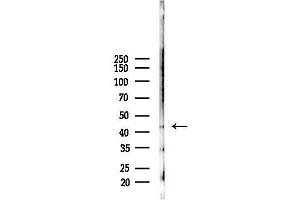 anti-Filamin Binding LIM Protein 1 (FBLIM1) (C-Term) antibody