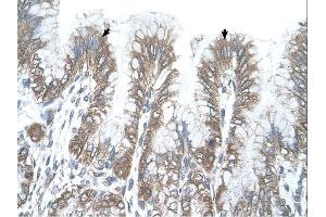 RSRC2 antibody was used for immunohistochemistry at a concentration of 4-8 ug/ml. (RSRC2 Antikörper  (C-Term))