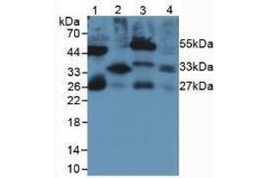 Western blot analysis of (1) Rat Serum, (2) Rat Lung Tissue, (3) Rat Intestine Tissue and (4) Rat Large Intestine Tissue. (IL-33 Antikörper  (AA 110-261))