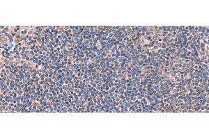 Immunohistochemistry of paraffin-embedded Human tonsil tissue using PEPD Polyclonal Antibody at dilution of 1:70(x200) (PEPD Antikörper)