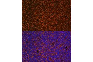 Immunofluorescence analysis of mouse embryos cells using PTCH1 antibody (ABIN1682368, ABIN1682367, ABIN3015342, ABIN3015343 and ABIN6213997) at dilution of 1:100. (Patched 1 Antikörper  (AA 1214-1312))