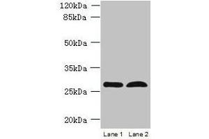 Western blot All lanes: RTP4 antibody at 5 μg/mL Lane 1: K562 whole cell lysate Lane 2: Mouse thymus tissue Secondary Goat polyclonal to rabbit IgG at 1/10000 dilution Predicted band size: 28 kDa Observed band size: 28 kDa