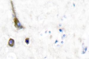 Image no. 1 for anti-Potassium Voltage-Gated Channel, Shaw-Related Subfamily, Member 2 (KCNC2) antibody (ABIN271788)