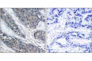 Immunohistochemistry (IHC) image for anti-Insulin Receptor Substrate 1 (IRS1) (pSer307) antibody (ABIN2888447) (IRS1 Antikörper  (pSer307))