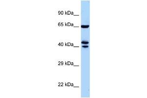 WB Suggested Anti-Zfp583 Antibody Titration: 1. (ZNF583 Antikörper  (Middle Region))