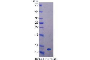 Image no. 1 for Glutathione Peroxidase 3 (Plasma) (GPX3) (AA 3-72) protein (His tag) (ABIN6238110)