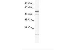 Image no. 1 for anti-Zinc Finger, Matrin-Type 1 (ZMAT1) (AA 359-408) antibody (ABIN6736003) (ZMAT1 Antikörper  (AA 359-408))
