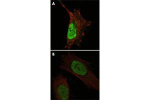 Confocal immunofluorescence analysis of cells using MDM4 monoclonal antobody, clone 2D10F4  (green). (MDM4-binding Protein Antikörper)