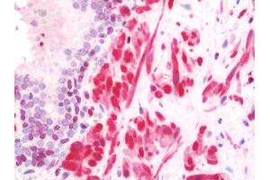 Anti-TAGLN / Transgelin / SM22 antibody IHC staining of human prostate. (Transgelin Antikörper  (HRP))