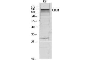 Western Blotting (WB) image for anti-Platelet/endothelial Cell Adhesion Molecule (PECAM1) (Thr224) antibody (ABIN6284729)