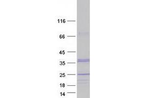 Validation with Western Blot (CHMP1A Protein (Transcript Variant 2) (Myc-DYKDDDDK Tag))