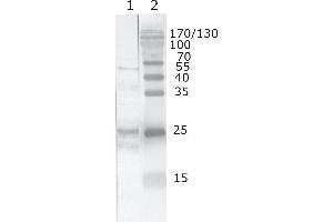 Western Blot testing of HIV-1 recombinant Tat protein. (HIV-1 Tat Antikörper  (AA 71-81))