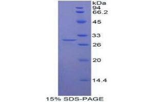 SDS-PAGE (SDS) image for E3 ubiquitin-protein ligase MIB2 (MIB2) (AA 687-930) protein (His tag) (ABIN1878404)