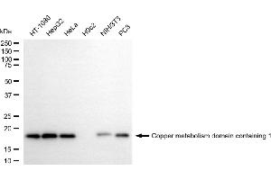 Western blotting analysis using copper metabolism domain containing 1 antibody (ABIN7798153).