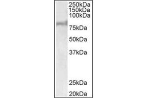 Western Blotting (WB) image for anti-ATP-Binding Cassette, Sub-Family D (ALD), Member 2 (Abcd2) (AA 460-473), (Internal Region) antibody (ABIN1105183) (Abcd2 Antikörper  (Internal Region))