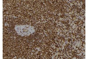 ABIN6268644 at 1/100 staining Rat spleen tissue by IHC-P. (JAK1 Antikörper)